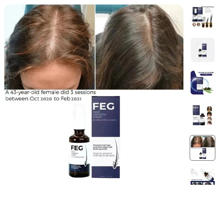 Hair Growth Spray | بخاخ العناية بنمو الشعر